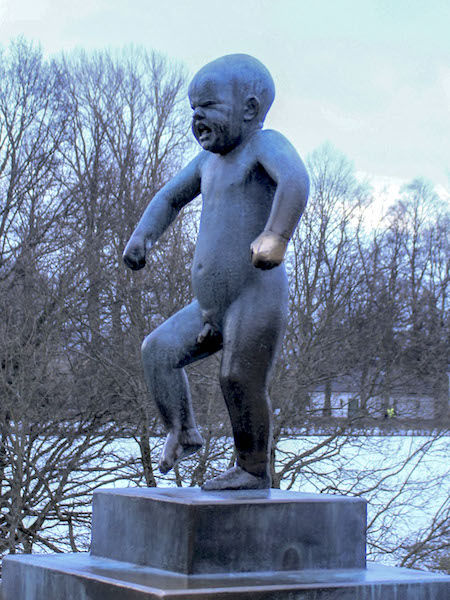 Vigeland infant in extremis.